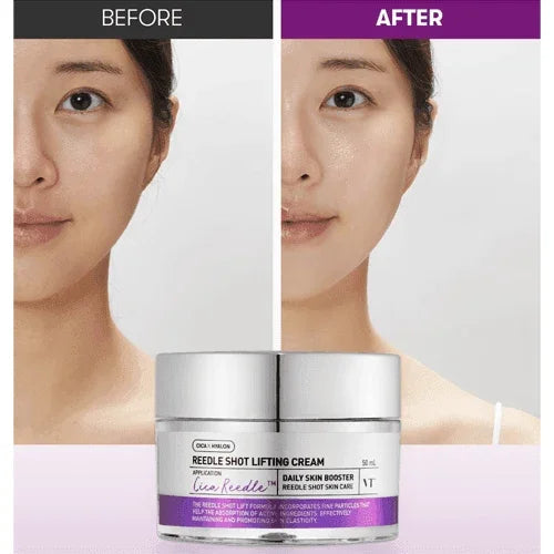 [VT Cosmetics] Reedle Shot Lifting Cream 50ml