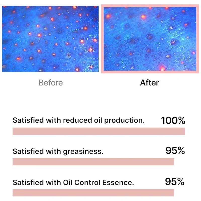 [celimax] Oil Control Capsule Essence 30ml