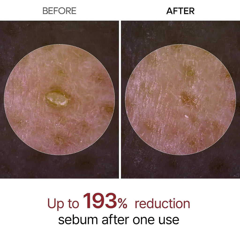 [Dr.Melaxin] Peel Shot Exfoliating Black Rice Ampoule 80ml