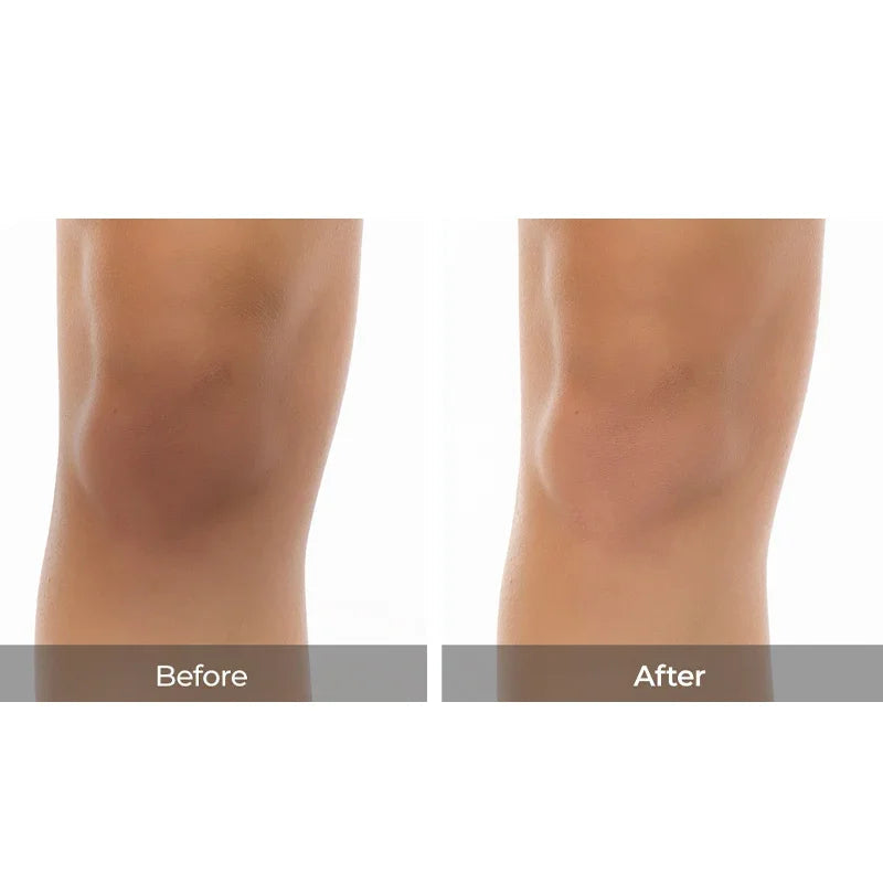 [Dr.Melaxin] Peel Shot Exfoliating TX-Spray 200ml