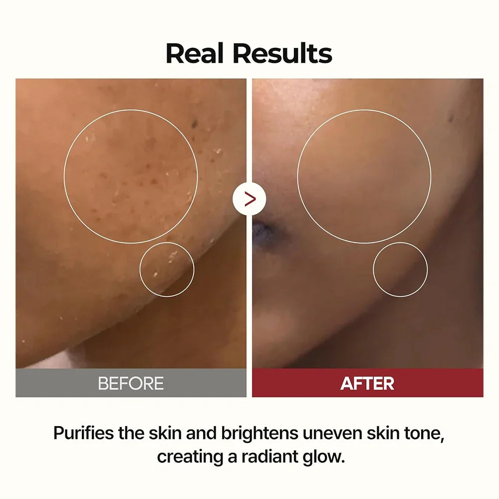 [Dr.Melaxin] Peel Shot Glow White Rice Toner 200ml