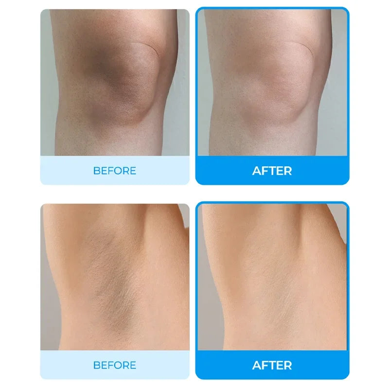 [Dr.Melaxin] TX-Capsule Body Cream 200g