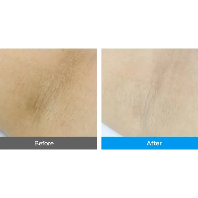[Dr.Melaxin] TX-Capsule Body Cream 200g