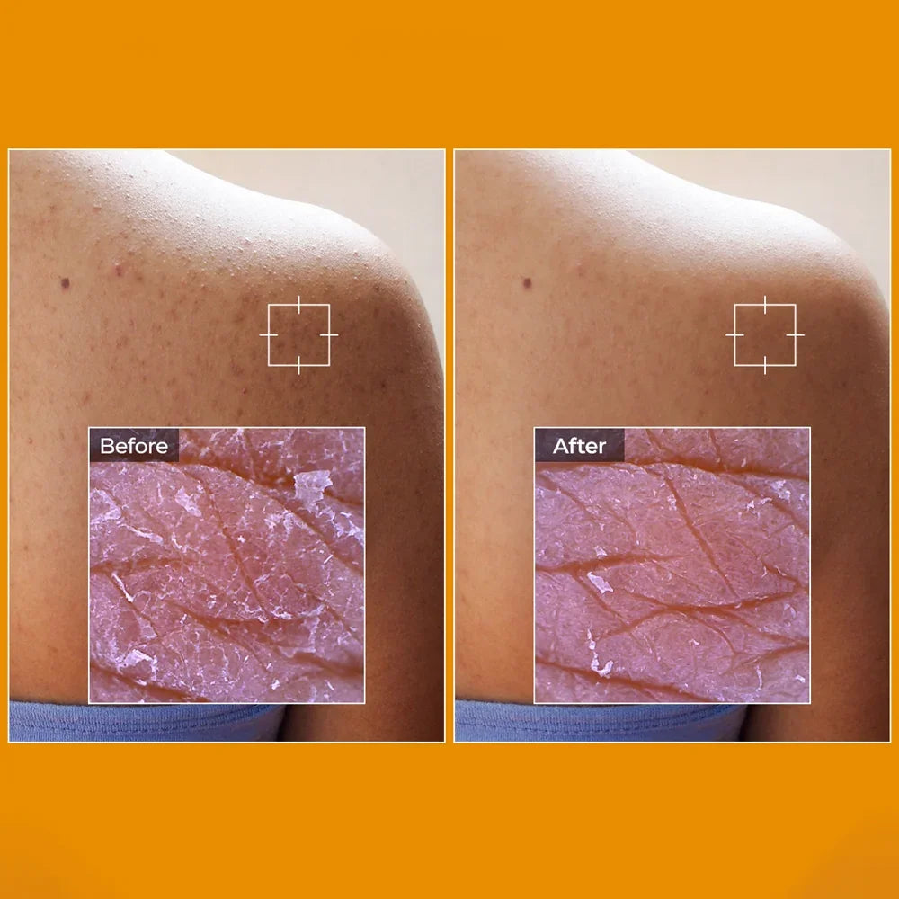 [Dr.Melaxin] TX-Kojic Acid Turmeric Toner Pad 190ml 70EA