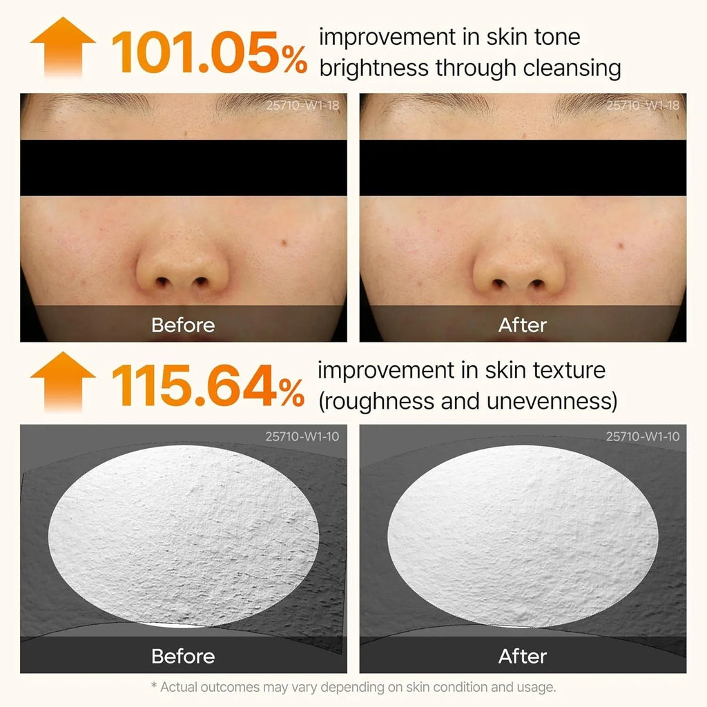 [Dr.Melaxin] Peel Shot Exfoliating Kojic Acid Turmeric Serum 80ml