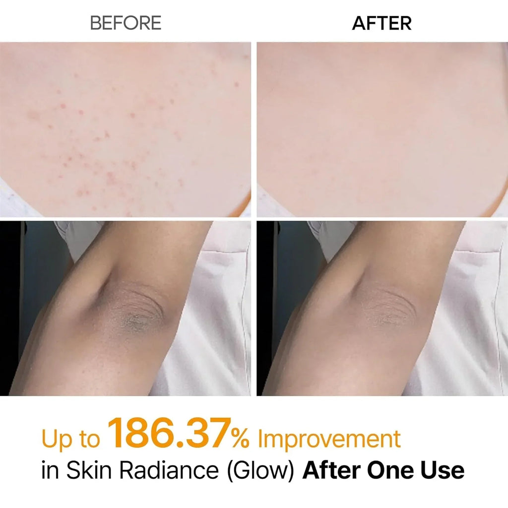 [Dr.Melaxin] Peel Shot Exfoliating Kojic Acid Turmeric Spray 200ml