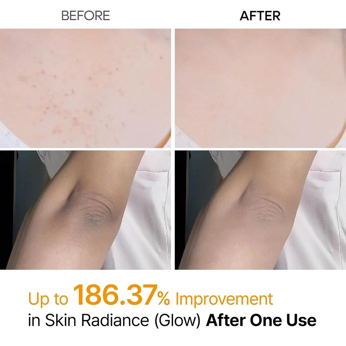 [Dr.Melaxin] Peel Shot Exfoliating Kojic Acid Turmeric Spray 200ml
