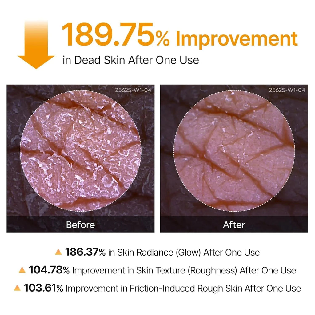 [Dr.Melaxin] Peel Shot Exfoliating Kojic Acid Turmeric Spray 200ml